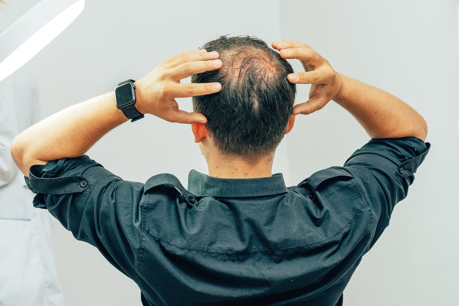 A balding man with his back to the camera