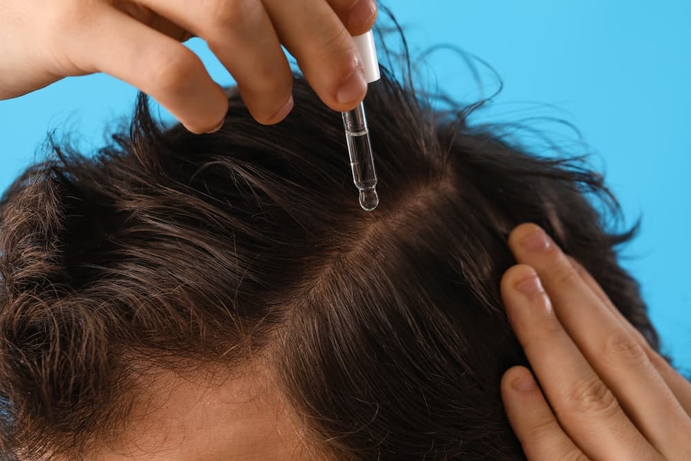 A man applying a topical treatment to his hair