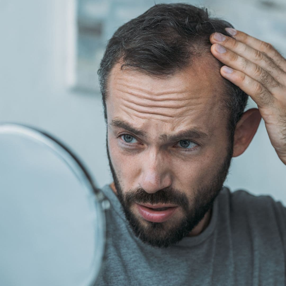 Man assessing his hairline in the mirror