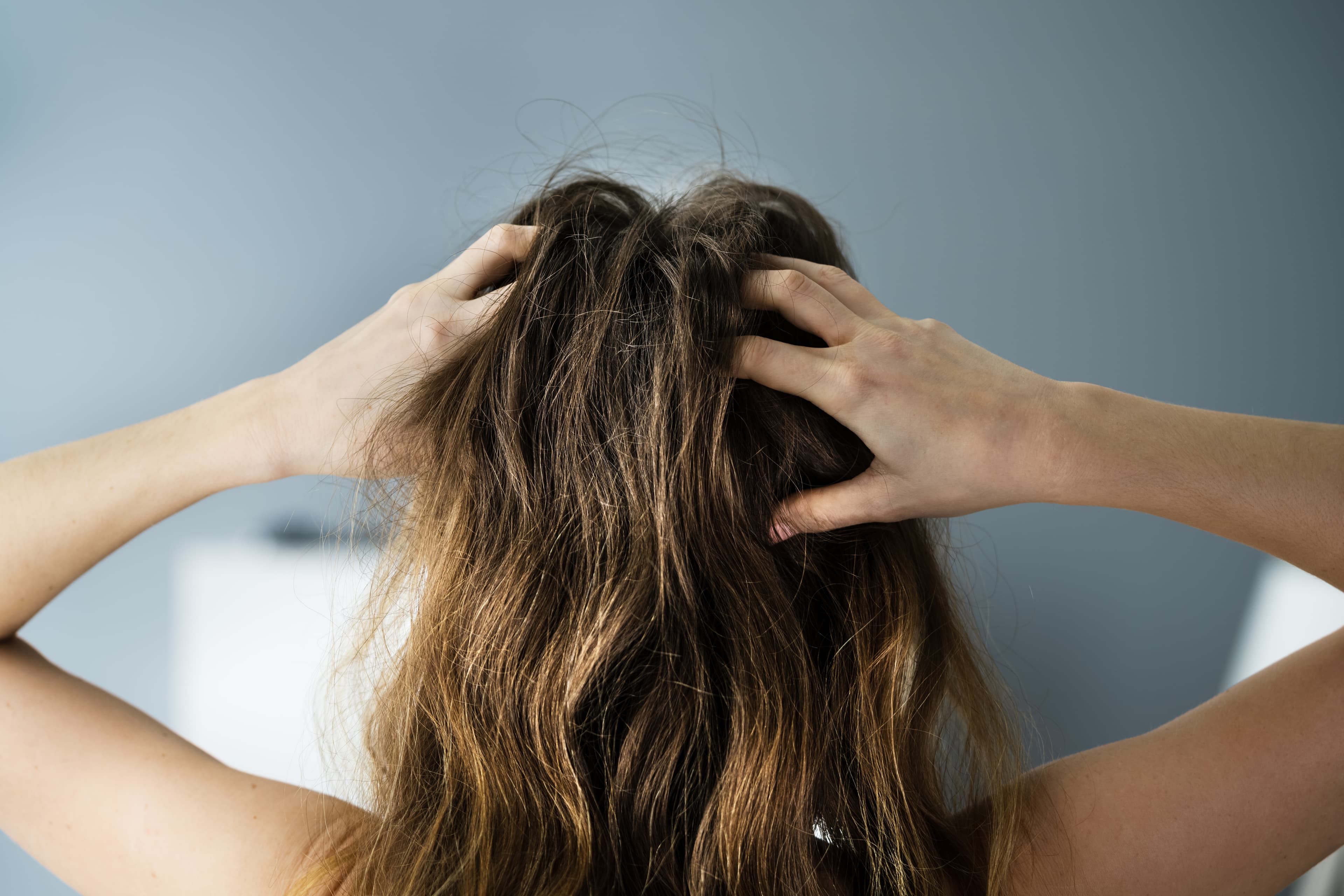 A lady scratching her itchy scalp