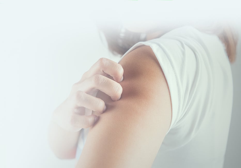 Bites & Stings Treatment