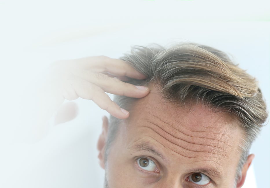 Hair Loss Treatment