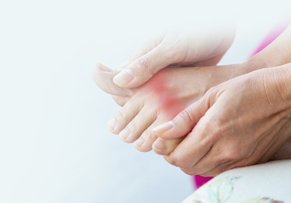 Gout Treatment